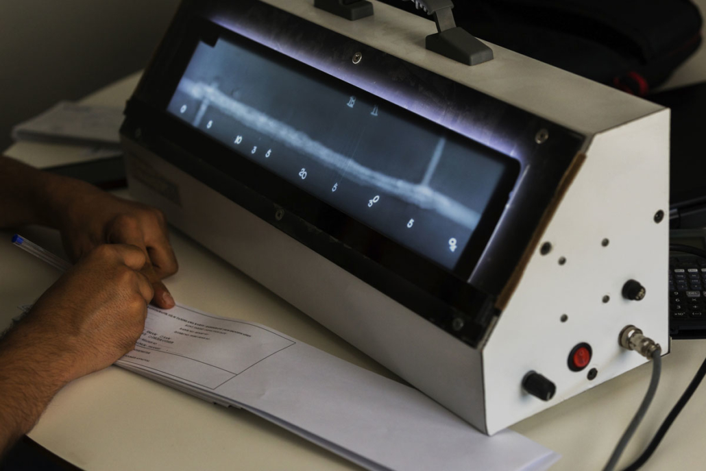 Radiography film being evaluated by NDT services provider in Edmonton